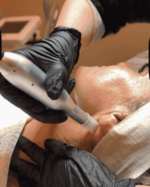 Microneedling München Gesicht, Hals & Dekolleté bei Königstöchter